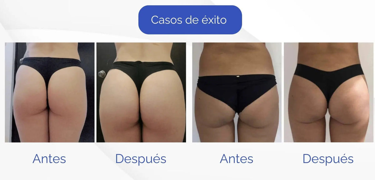 Peptonas y ezimas para gluteos fit depot mexico 